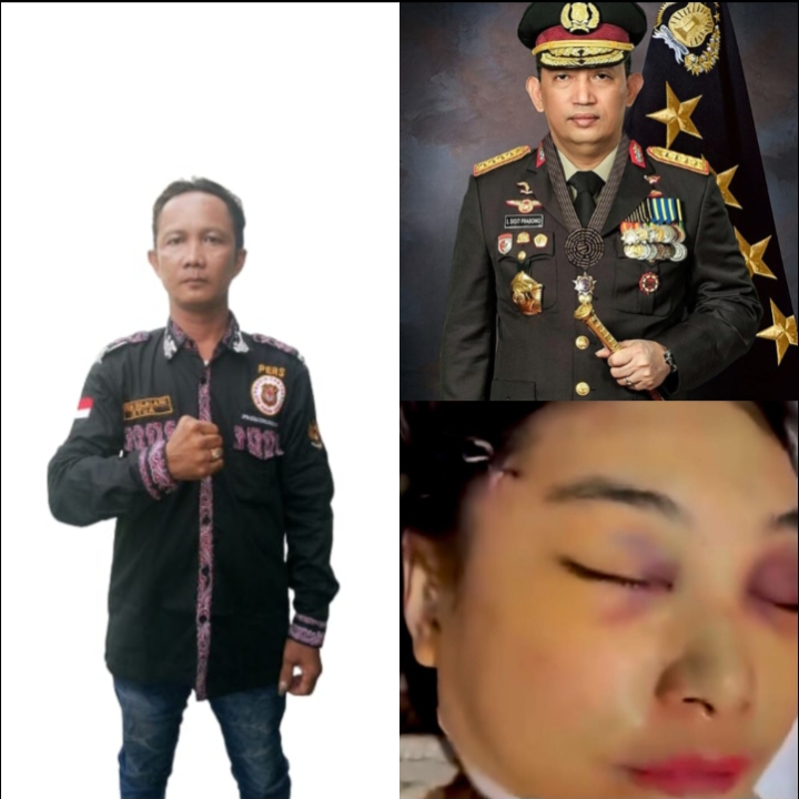 DPW Media Center LSM PAKAR Sumut Desak Kapolri Turun Tangan, Deretan Kejanggalan Kematian Ibu Bhayangkari Winda Lorenza Gowasa Dinilai Harus Dibuka Terang-Benderang